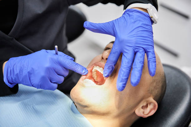 Best Cracked Tooth Emergency Dentist  in Capron, IL
